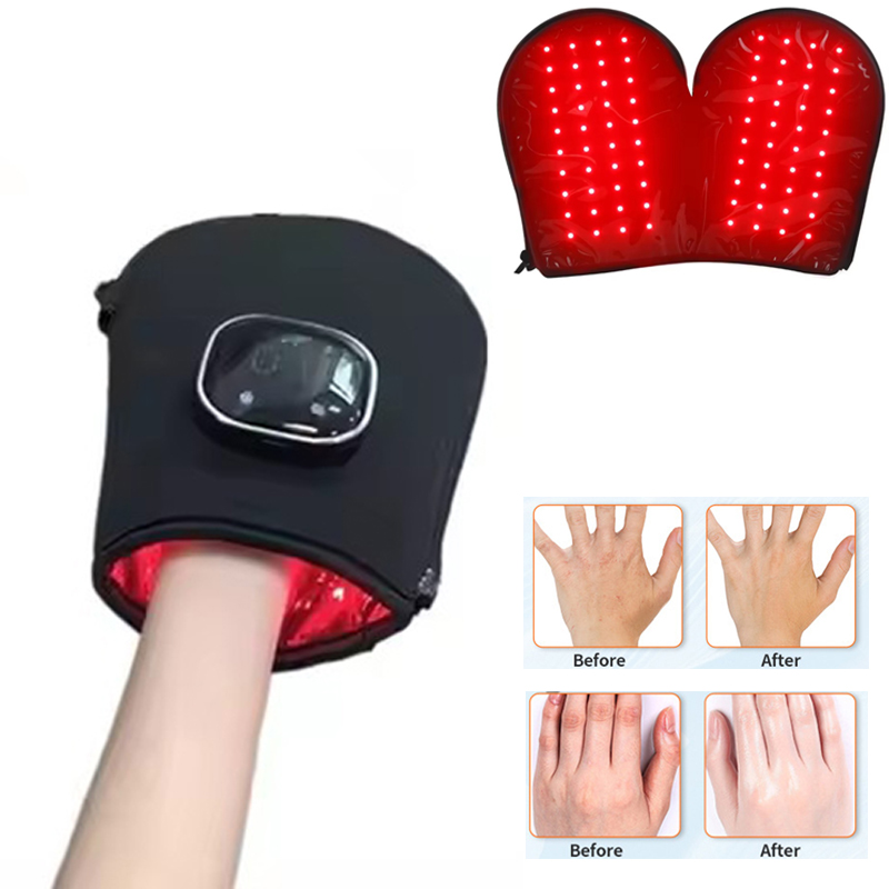Red Light Therapy Device - Perangkat Terapi Cahaya Merah Baru untuk